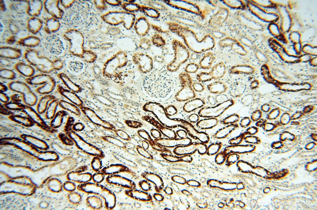 Immunohistochemistry (IHC) staining of human kidney tissue using CPB1 Polyclonal antibody (12600-1-AP)