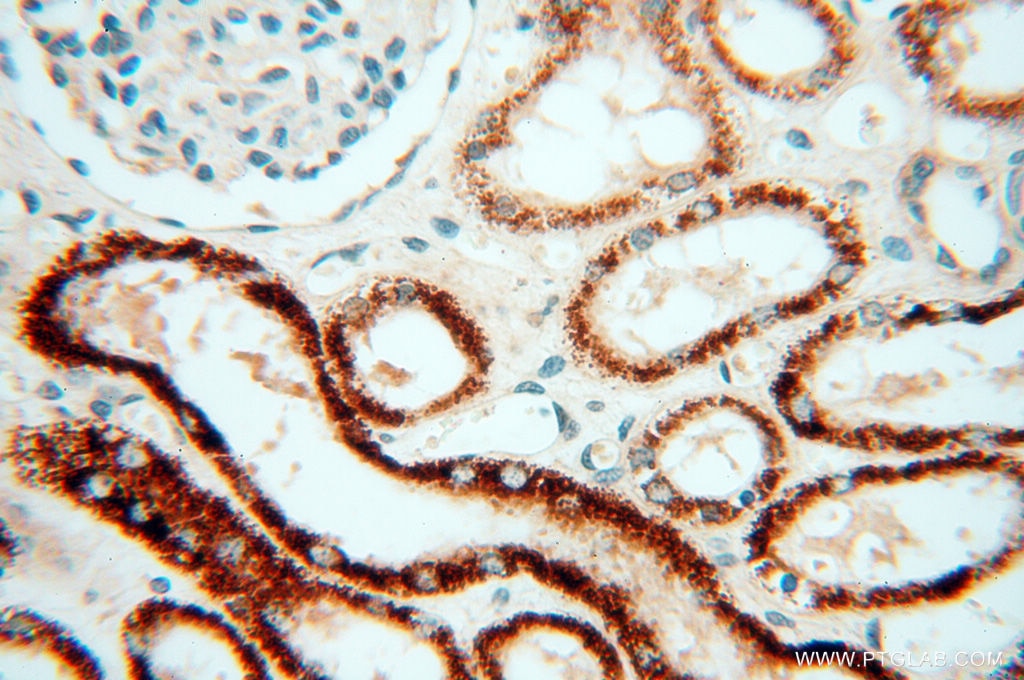 Immunohistochemistry (IHC) staining of human kidney tissue using CPB1 Polyclonal antibody (12600-1-AP)
