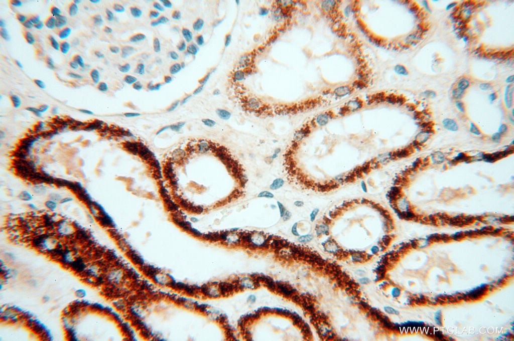 IHC staining of human kidney using 12600-1-AP