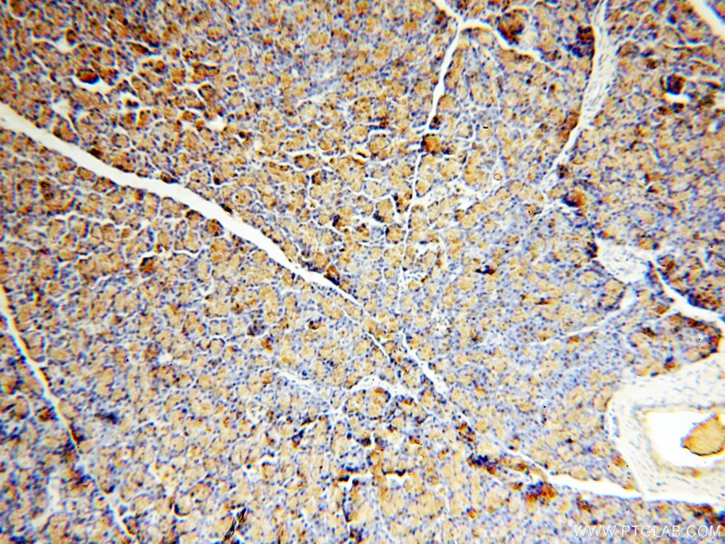 Immunohistochemistry (IHC) staining of human pancreas tissue using CPB1 Polyclonal antibody (12600-1-AP)