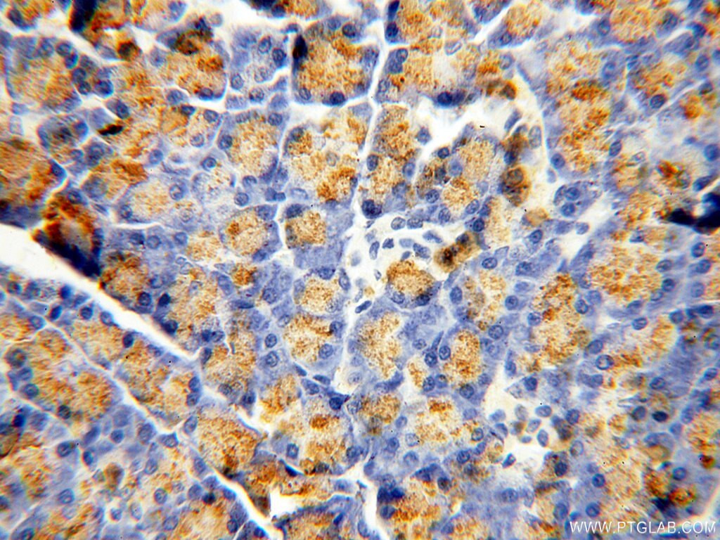 Immunohistochemistry (IHC) staining of human pancreas tissue using CPB1 Polyclonal antibody (12600-1-AP)