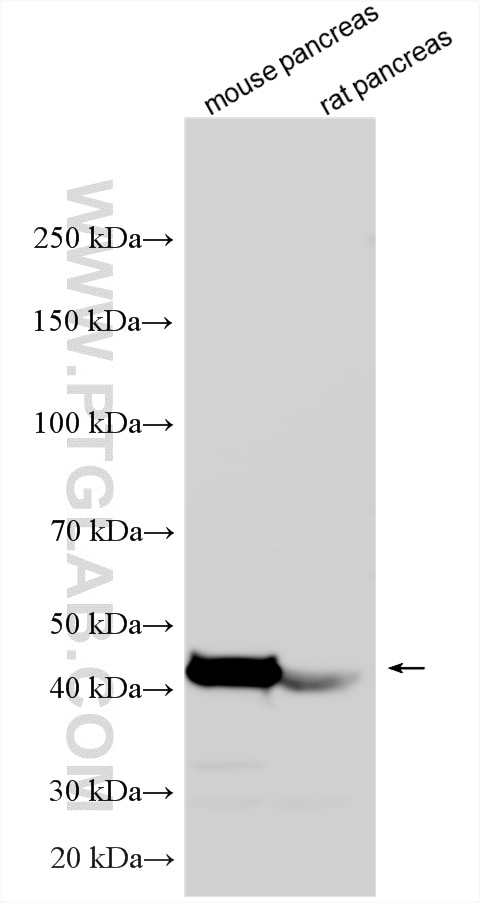 Western Blot (WB) analysis of various lysates using CPB1 Polyclonal antibody (12600-1-AP)