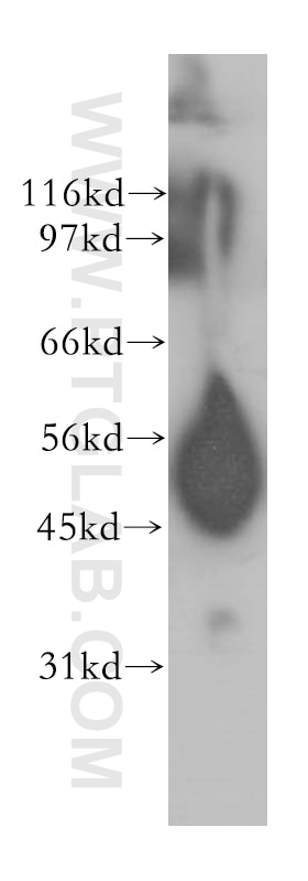 Western Blot (WB) analysis of mouse pancreas tissue using CPB1 Polyclonal antibody (12600-1-AP)