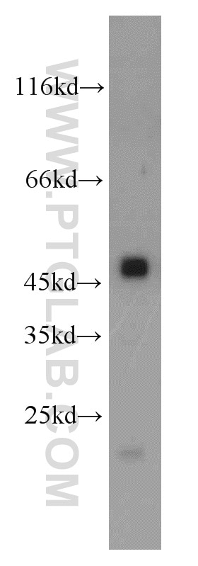 Western Blot (WB) analysis of mouse pancreas tissue using CPB1 Polyclonal antibody (12600-1-AP)