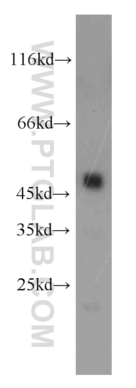 Western Blot (WB) analysis of mouse pancreas tissue using CPB1 Polyclonal antibody (12600-1-AP)