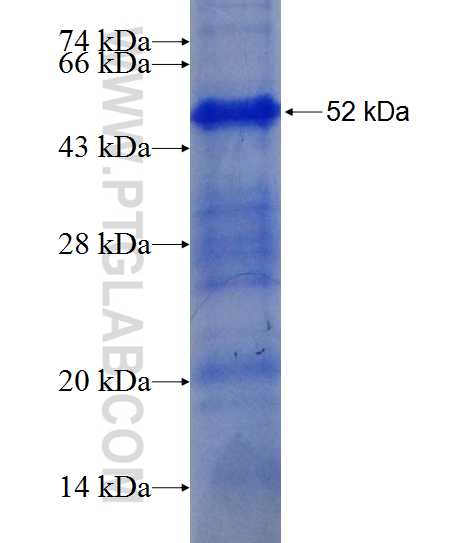 PASP fusion protein Ag21035 SDS-PAGE