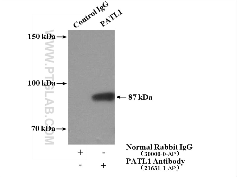 Immunoprecipitation (IP) experiment of K-562 cells using PATL1 Polyclonal antibody (21631-1-AP)