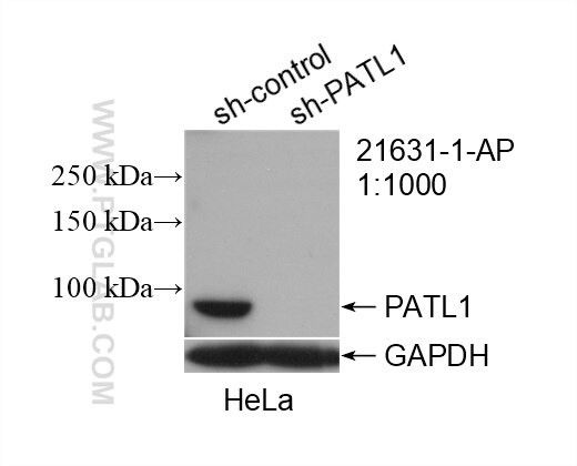 Western Blot (WB) analysis of HeLa cells using PATL1 Polyclonal antibody (21631-1-AP)