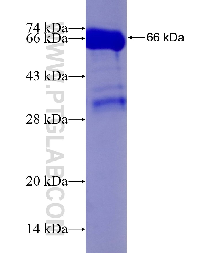 PATL1 fusion protein Ag16247 SDS-PAGE