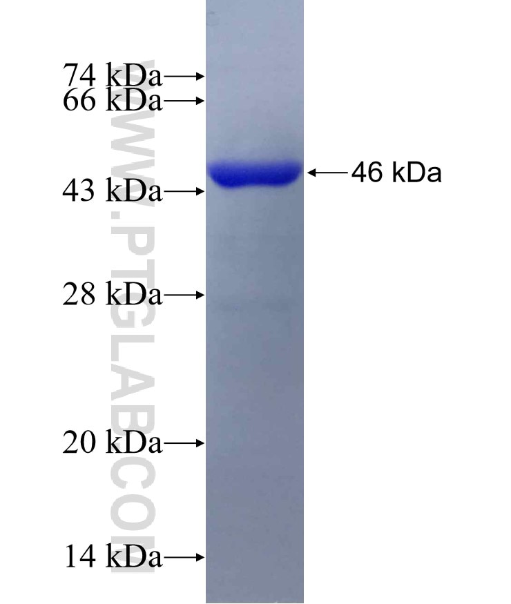 PATL1 fusion protein Ag16315 SDS-PAGE