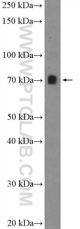 Western Blot (WB) analysis of mouse spleen tissue using PATZ1 Polyclonal antibody (26225-1-AP)