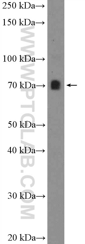 WB analysis of mouse spleen using 26225-1-AP