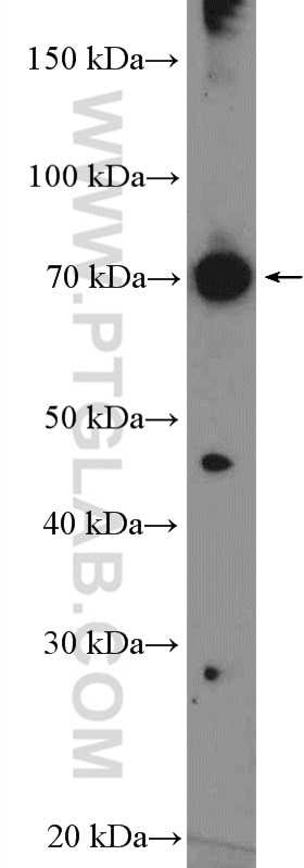 Western Blot (WB) analysis of Raji cells using PATZ1 Polyclonal antibody (26225-1-AP)