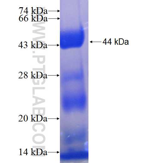 PATZ1 fusion protein Ag23912 SDS-PAGE
