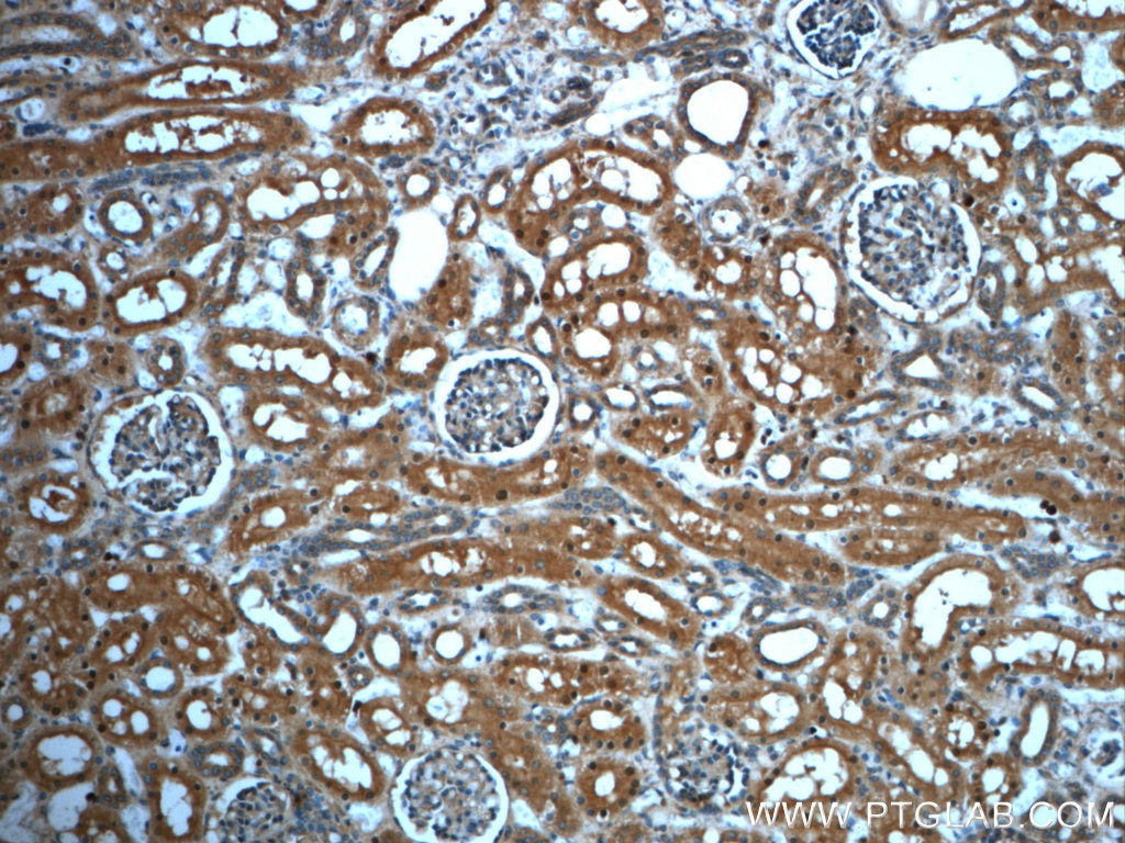 Immunohistochemistry (IHC) staining of human kidney tissue using PAWR Polyclonal antibody (20688-1-AP)