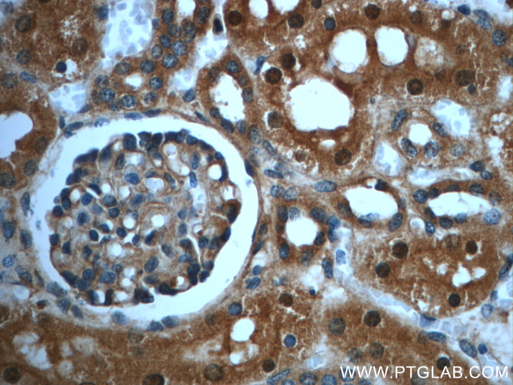 Immunohistochemistry (IHC) staining of human kidney tissue using PAWR Polyclonal antibody (20688-1-AP)