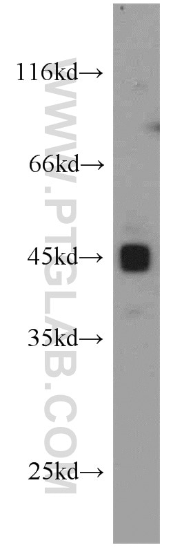 Western Blot (WB) analysis of mouse kidney tissue using PAWR Polyclonal antibody (20688-1-AP)