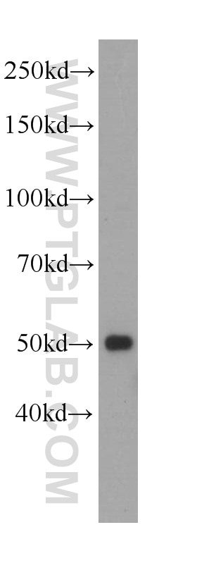 Western Blot (WB) analysis of K-562 cells using PAX1-Specific Monoclonal antibody (60217-1-Ig)