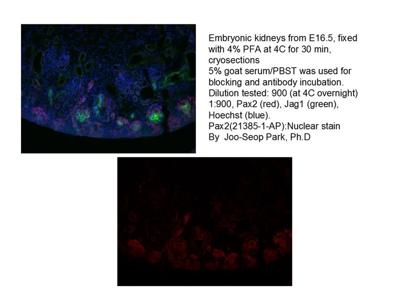 PAX2 Polyclonal antibody