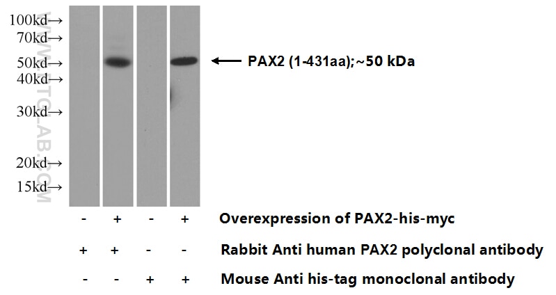 PAX2 Polyclonal antibody