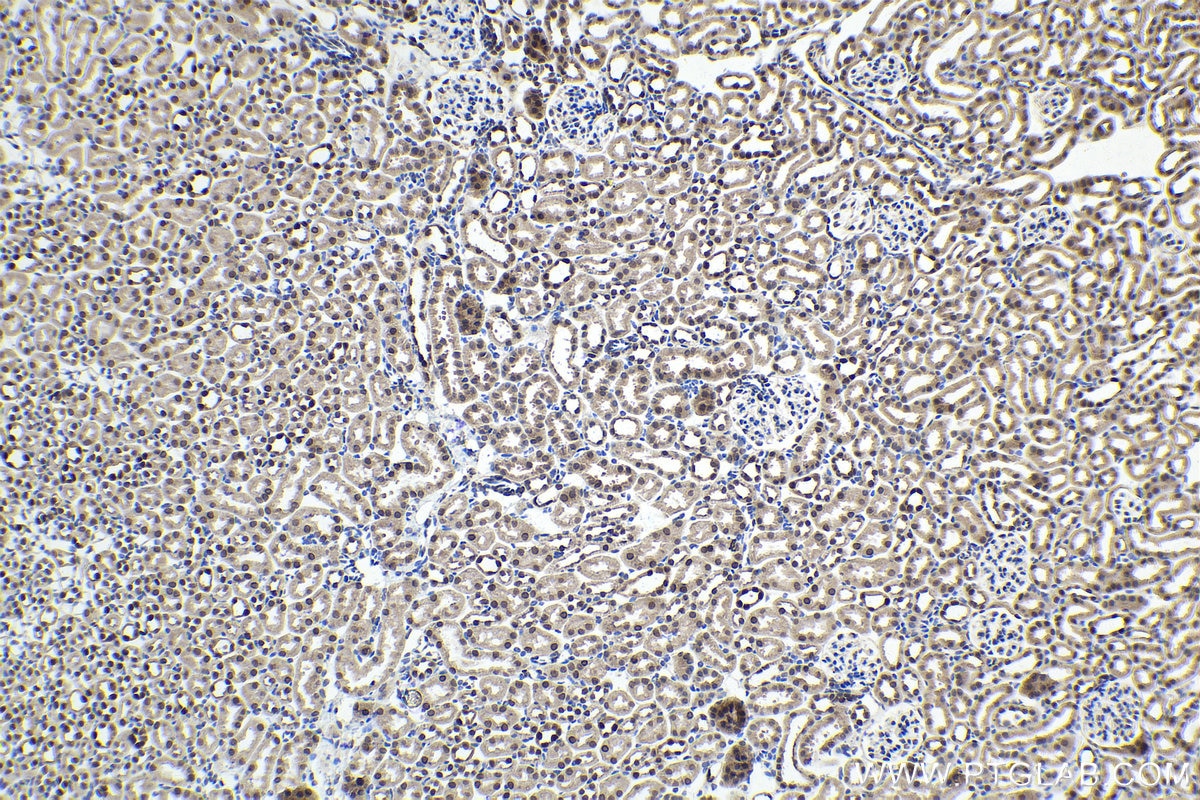 Immunohistochemistry (IHC) staining of mouse kidney tissue using PAX2 Polyclonal antibody (29307-1-AP)