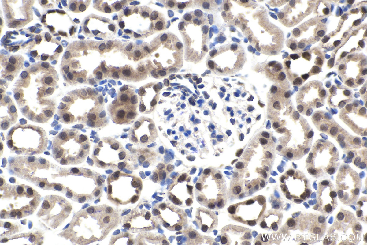 Immunohistochemistry (IHC) staining of mouse kidney tissue using PAX2 Polyclonal antibody (29307-1-AP)