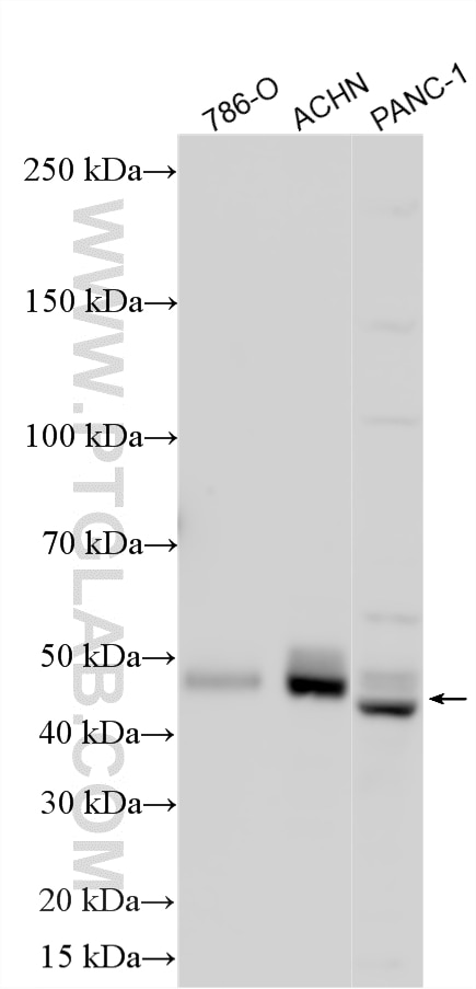 WB analysis using 29307-1-AP Western Blot (WB) analysis of various lysates using PAX2 Polyclonal antibody (29307-1-AP)