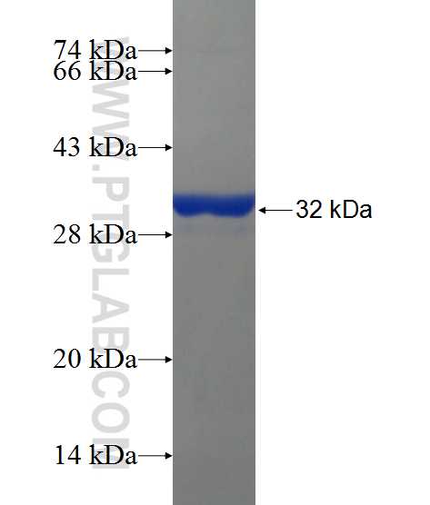 PAX2 fusion protein Ag24614 SDS-PAGE