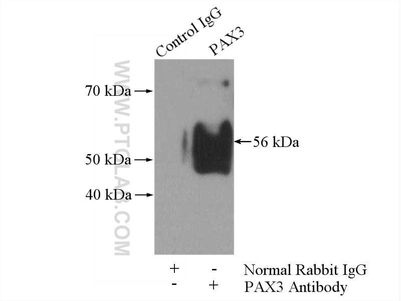 Immunoprecipitation (IP) experiment of mouse skin tissue using PAX3 Polyclonal antibody (21386-1-AP)