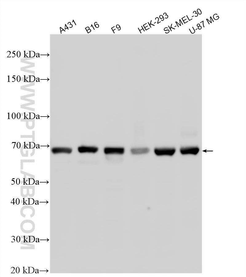 Various lysates were subjected to SDS PAGE followed by western blot with 21386-1-AP (PAX3 antibody) at dilution of 1:2000 incubated at room temperature for 1.5 hours. Western Blot (WB) analysis of various lysates using PAX3 Polyclonal antibody (21386-1-AP)
