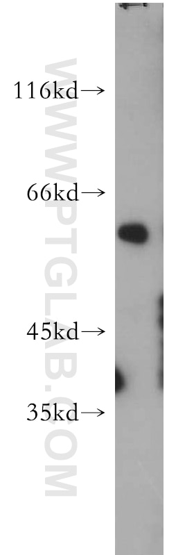 Western Blot (WB) analysis of mouse skin tissue using PAX3 Polyclonal antibody (21386-1-AP)