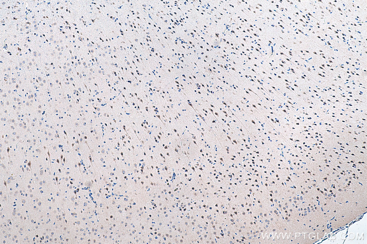 Immunohistochemistry (IHC) staining of rat brain tissue using PAX3 Polyclonal antibody (51036-2-AP)