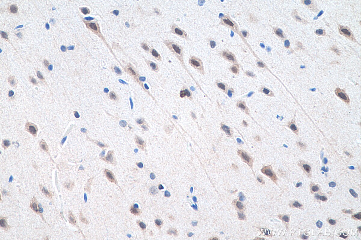 Immunohistochemistry (IHC) staining of rat brain tissue using PAX3 Polyclonal antibody (51036-2-AP)