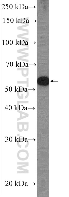 Western Blot (WB) analysis of mouse skin tissue using PAX3 Polyclonal antibody (51036-2-AP)