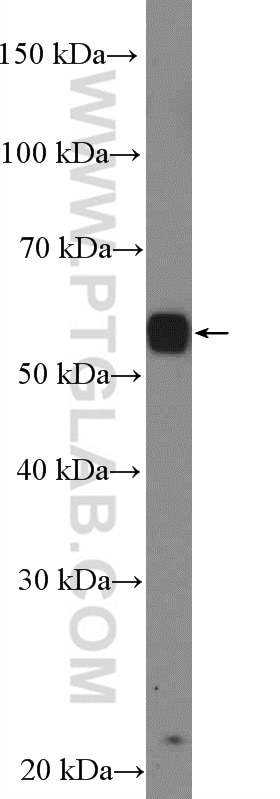Western Blot (WB) analysis of A375 cells using PAX3 Polyclonal antibody (51036-2-AP)