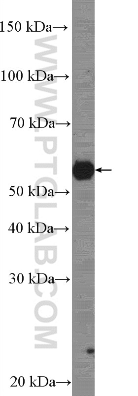 WB analysis of K-562 using 51036-2-AP