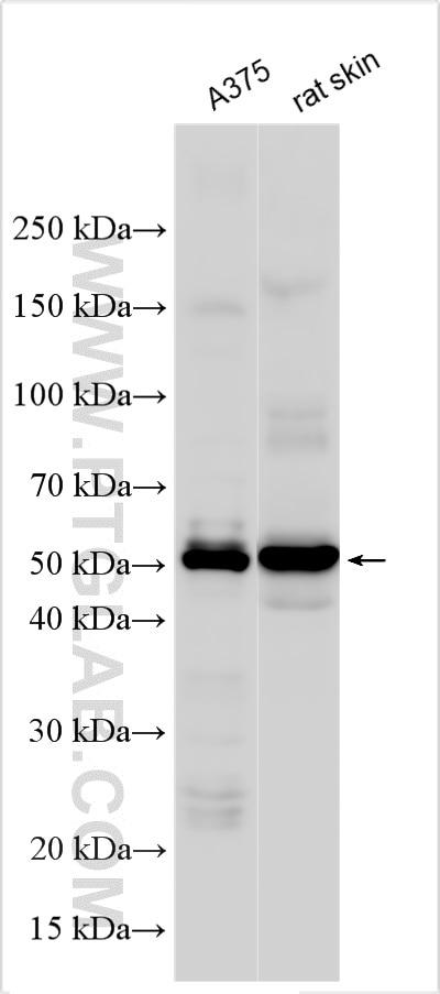 Western Blot (WB) analysis of various lysates using PAX3 Polyclonal antibody (51036-2-AP)