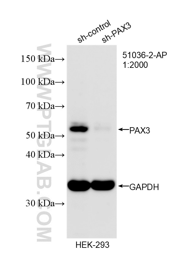 WB analysis of HEK-293 using 51036-2-AP Western Blot (WB) analysis of HEK-293 cells using PAX3 Polyclonal antibody (51036-2-AP)