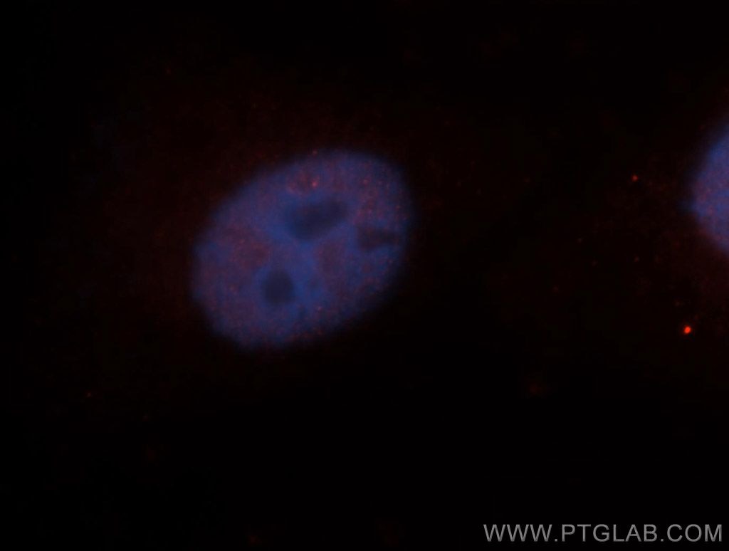 Immunofluorescence (IF) / fluorescent staining of A549 cells using PAX4 Polyclonal antibody (13018-2-AP)