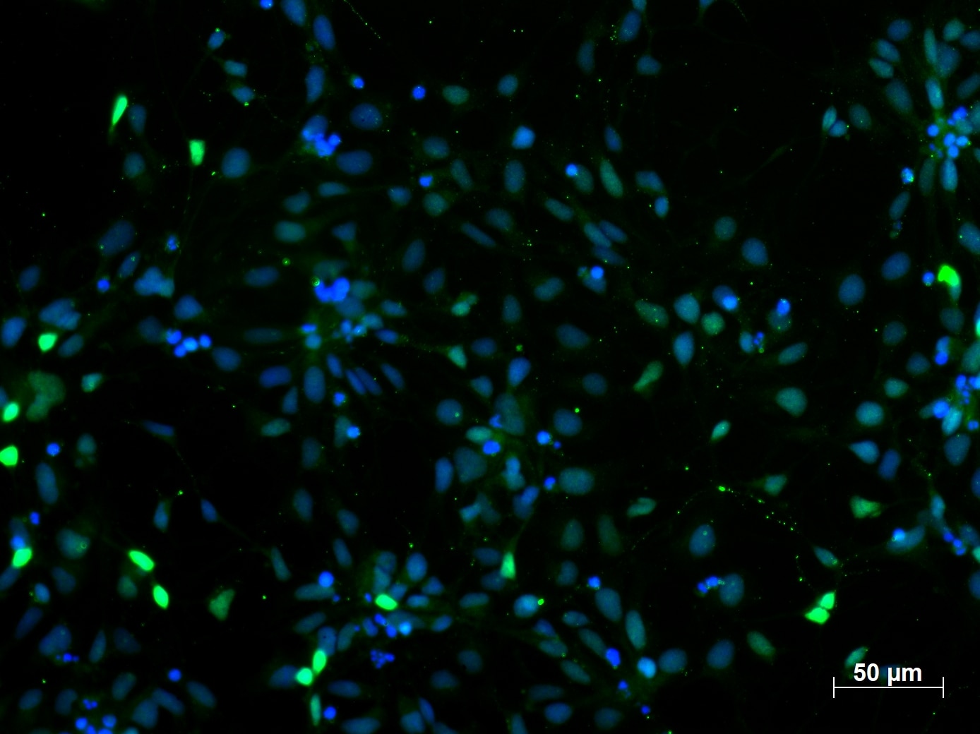 Immunofluorescence (IF) / fluorescent staining of iPS cells using PAX6 Polyclonal antibody (12323-1-AP)