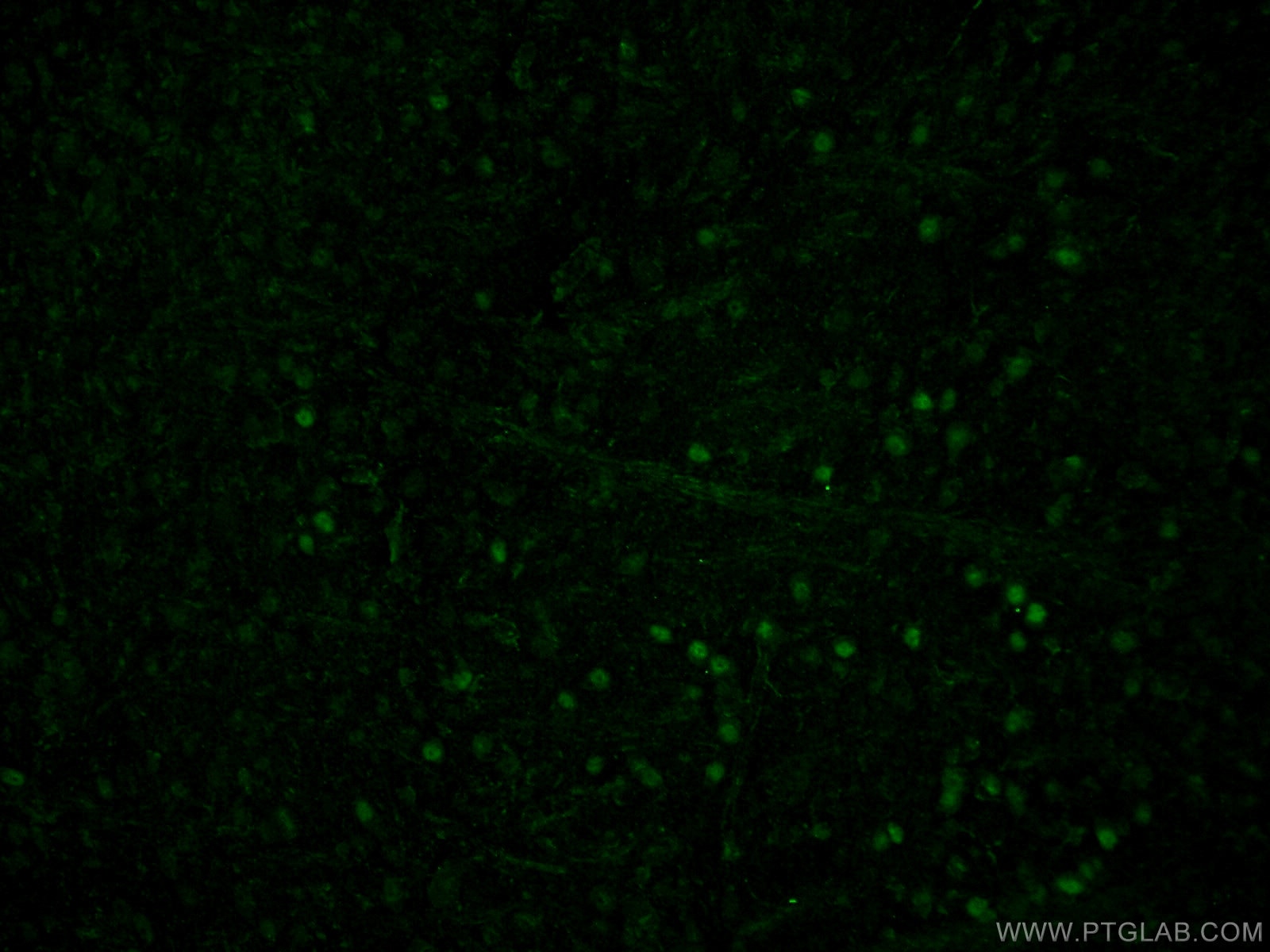 Immunofluorescence (IF) / fluorescent staining of mouse brain tissue using PAX6 Polyclonal antibody (12323-1-AP)