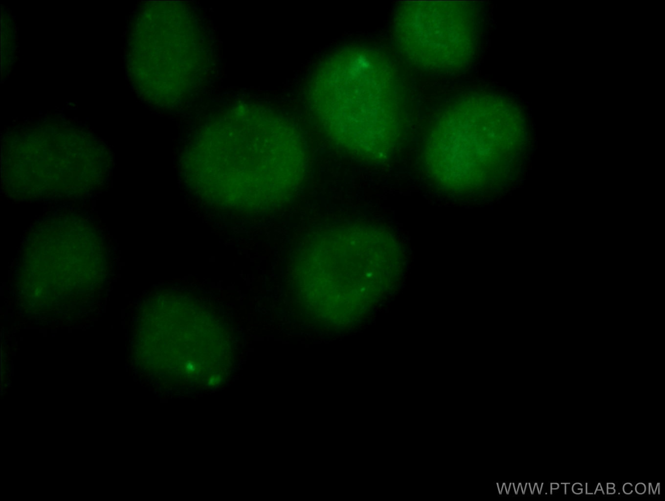 Immunofluorescence (IF) / fluorescent staining of Neuro-2a cells using PAX6 Polyclonal antibody (12323-1-AP)