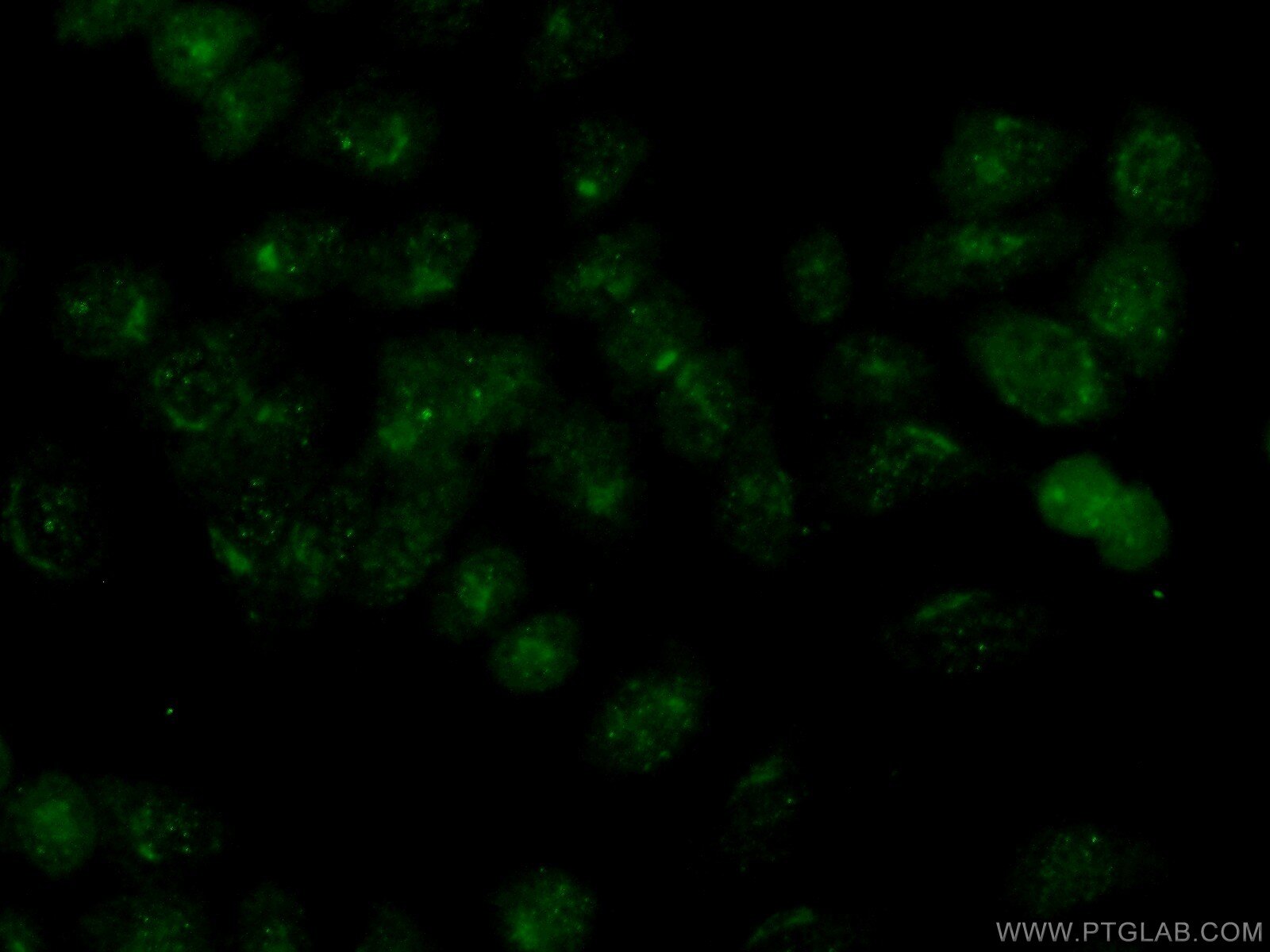 PAX6 Polyclonal antibody