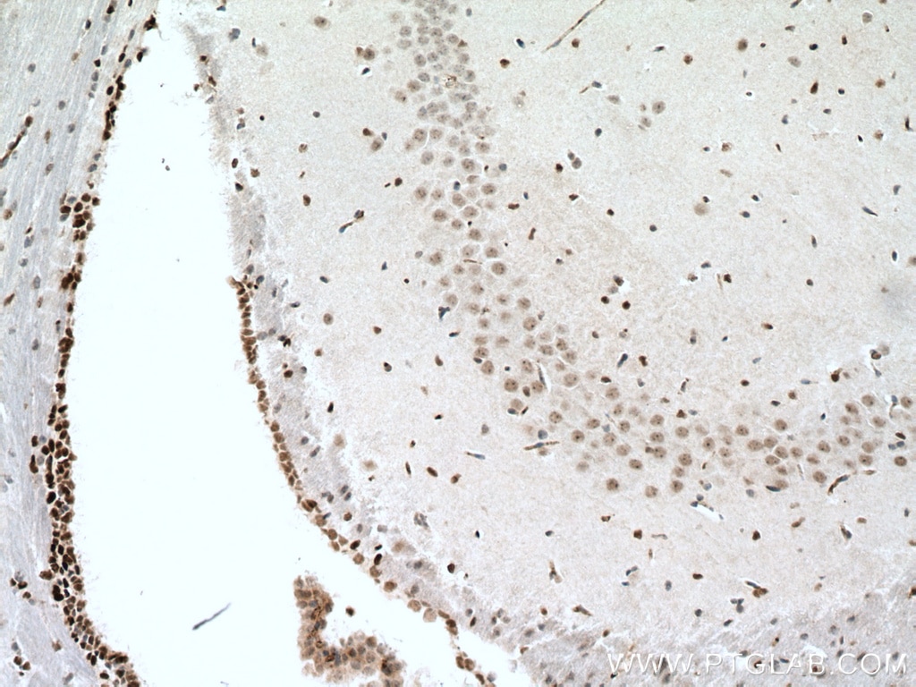 Immunohistochemistry (IHC) staining of mouse brain tissue using PAX6 Polyclonal antibody (12323-1-AP)