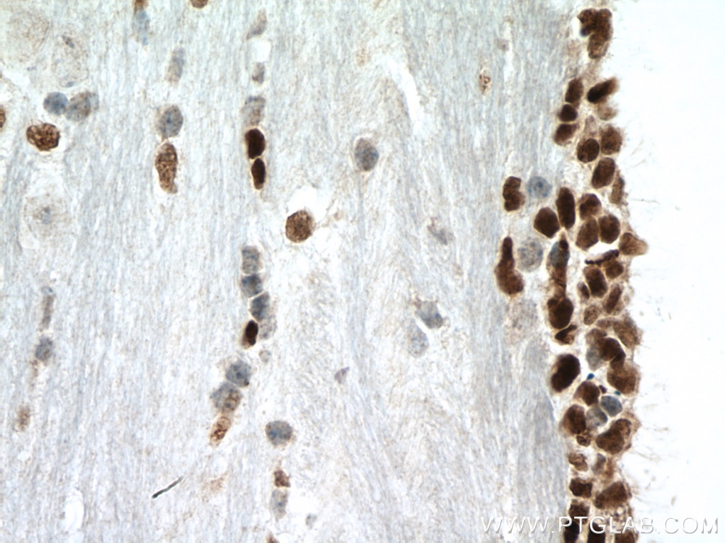 Immunohistochemistry (IHC) staining of mouse brain tissue using PAX6 Polyclonal antibody (12323-1-AP)