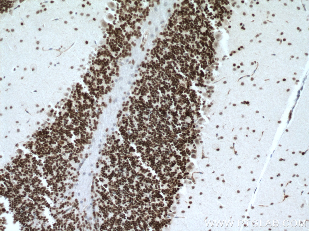 Immunohistochemistry (IHC) staining of mouse brain tissue using PAX6 Polyclonal antibody (12323-1-AP)