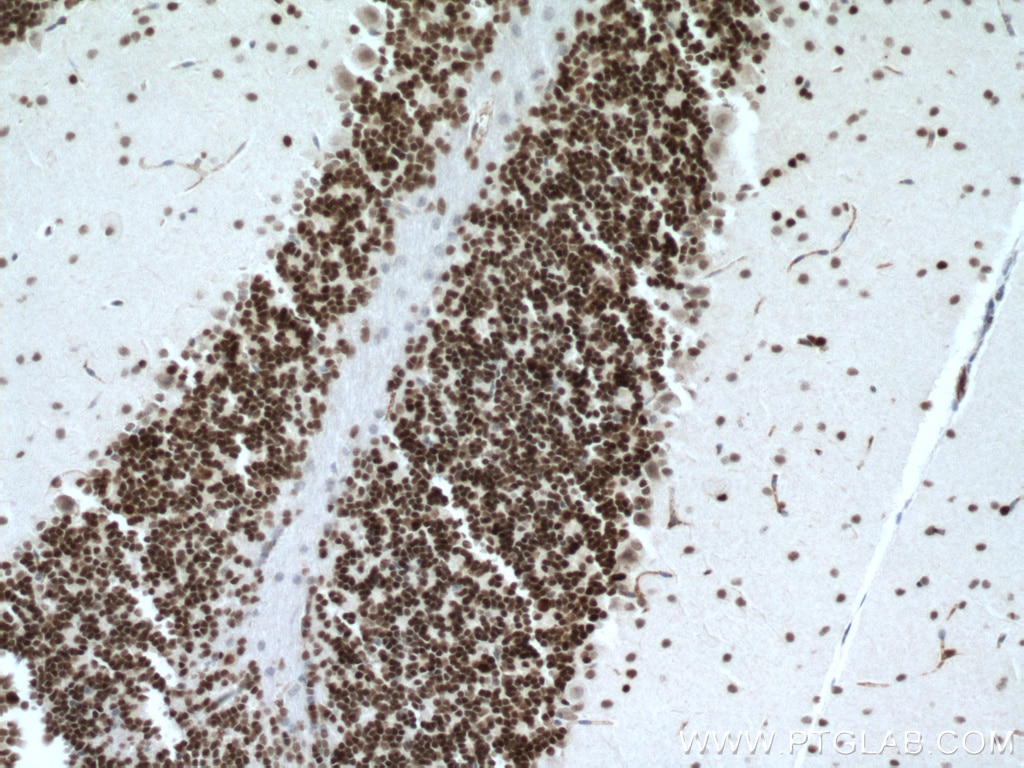 IHC staining of mouse brain using 12323-1-AP