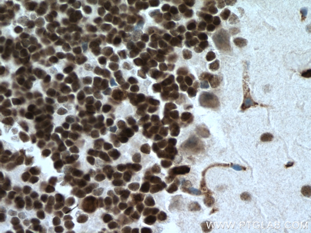 Immunohistochemistry (IHC) staining of mouse brain tissue using PAX6 Polyclonal antibody (12323-1-AP)