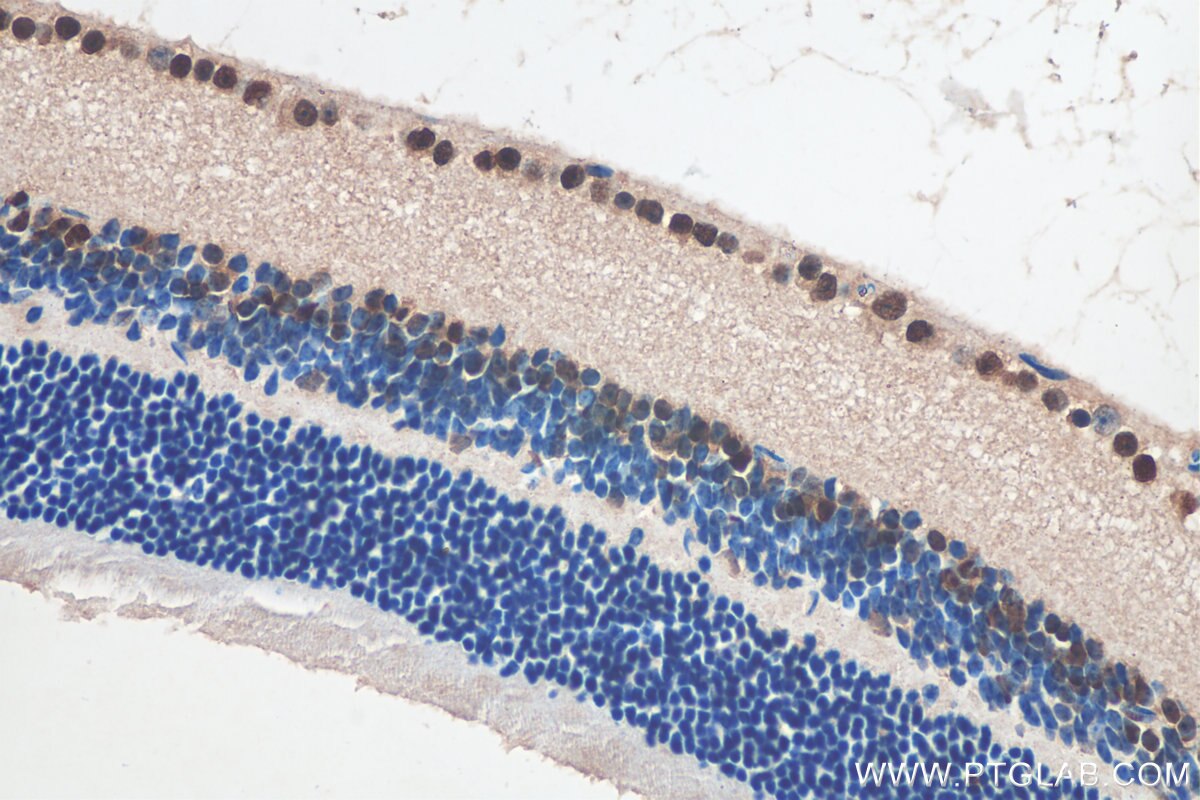 Immunohistochemistry (IHC) staining of mouse eye tissue using PAX6 Polyclonal antibody (12323-1-AP)