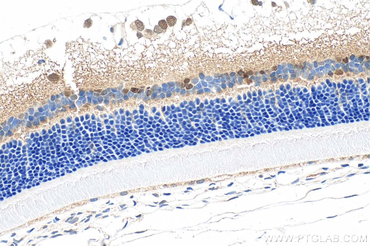 Immunohistochemistry (IHC) staining of rat eye tissue using PAX6 Polyclonal antibody (12323-1-AP)